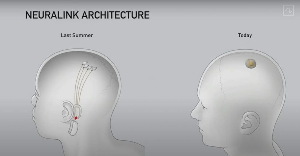 تقنية-نيورالينك-2-1024x535